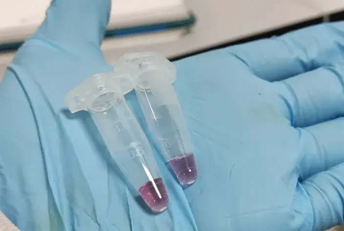 Nanopartículas de oro